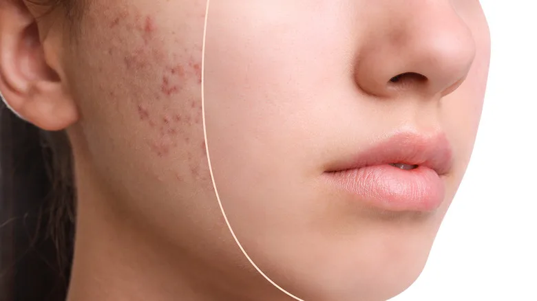 Read more about the article التصبغات الجلدية – أسبابها وأنواعها وطرق التخلص منها