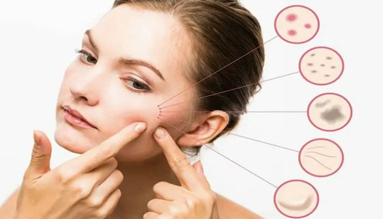 Read more about the article البشرة المختلطة وطرق العناية بها